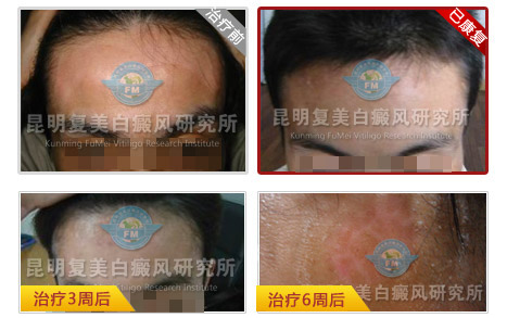 十大康复案例之八—拿什么来拯救你,我的母亲?女孩寻医六载 终让母亲再次绽放笑颜 十大康复案例之八—拿什么来拯救你,我的母亲?女孩寻医六载 终让母亲再次绽放笑颜